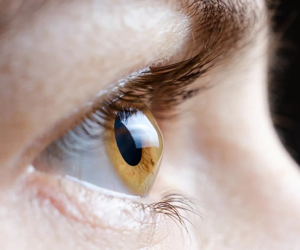 Oczy jak szpilki: co oznaczają rozszerzone źrenice i ich przyczyny Oczy jak szpilki: co oznaczają rozszerzone źrenice i ich przyczyny